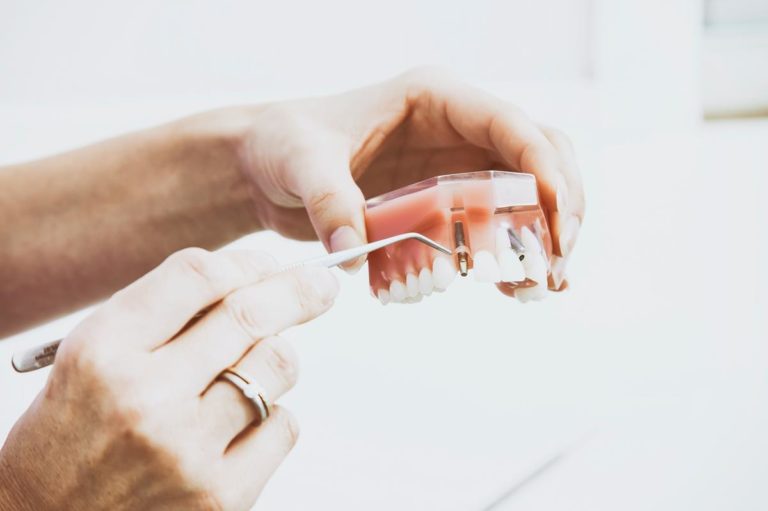 Kto powinien zgłosić się do ortodonty?