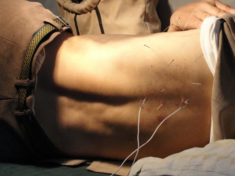 Wyjście z nałogu za pomocą akupunktury: klinika leczenia bólu we Wrocławiu